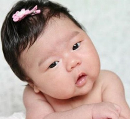 幼兒痙攣性斜頸的