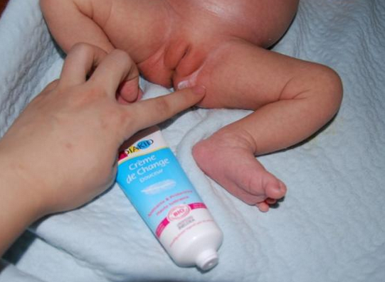 寶寶紅屁屁照片 (31) 