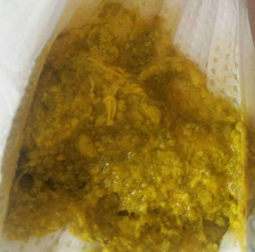 母乳性腹瀉危害