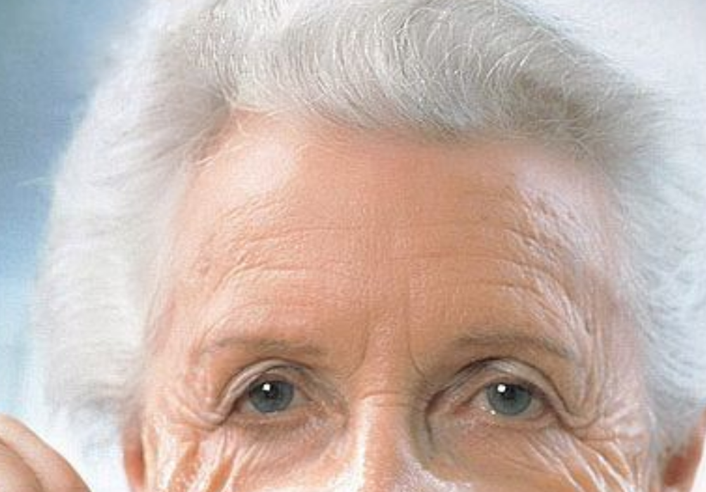 皮膚老化老年人