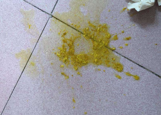 新生兒消化不良大便圖 (61) 