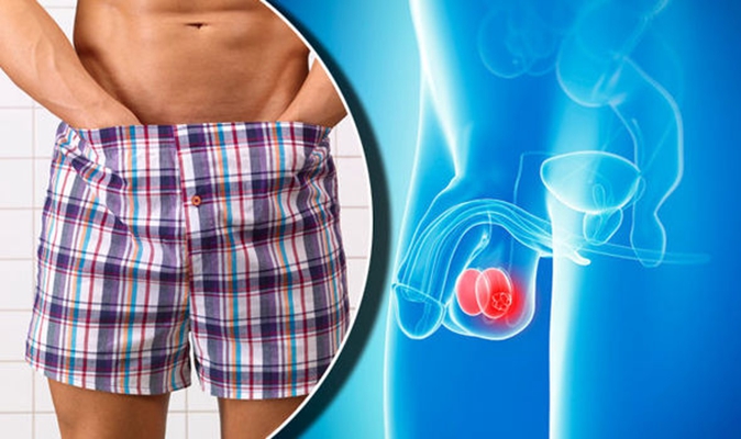 睪丸癌的早期症狀 (45) 