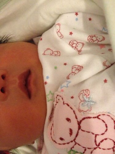 新生兒嘴唇發紫 (5) 