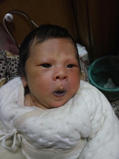 新生兒嘴唇發紫 (39) 