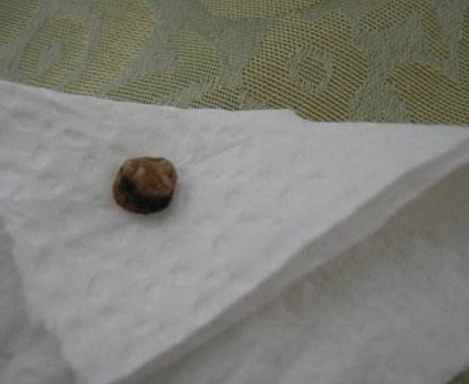 寶寶臍帶脫落後