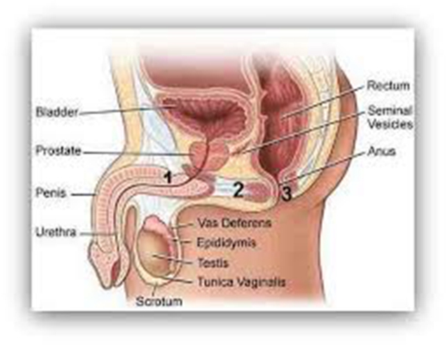 早期陰莖癌的圖解的