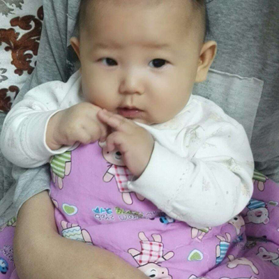 嬰兒肌張力高 (5) 