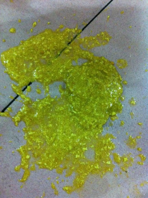 寶寶母乳性腹瀉大便呈蛋花樣