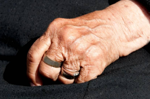 靜止性震顫 (47) 