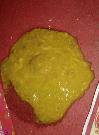 新生兒腹瀉大便