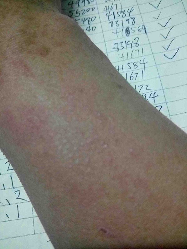 症狀流感初期檢查