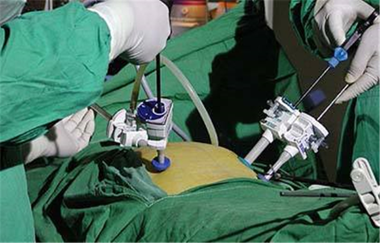 微創治療卵巢囊腫