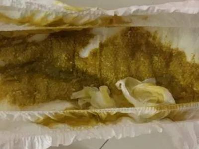 新生兒腹瀉大便