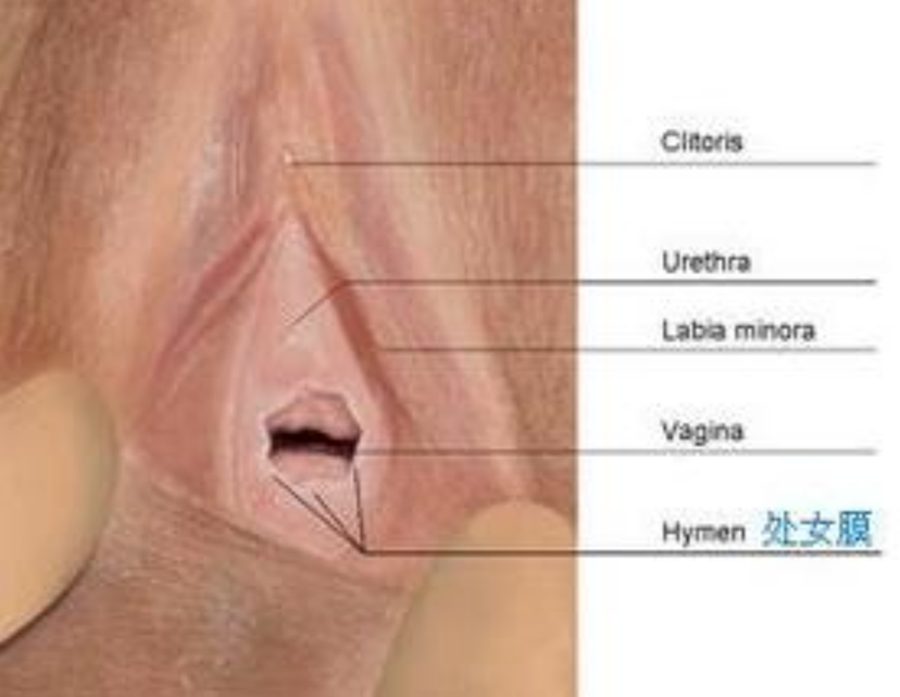 正常的處女膜