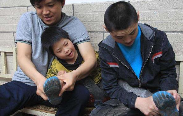 痙攣型腦癱 (57) 