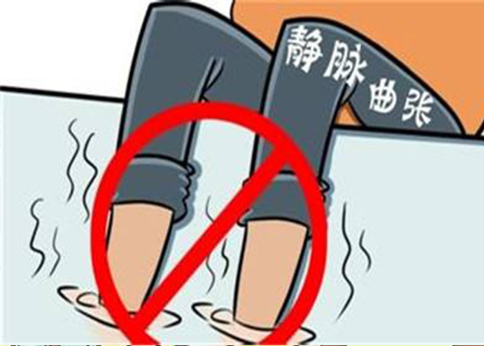 小腿靜脈曲張漫畫 