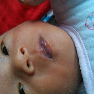 嬰兒嘴唇發紫 (53) 