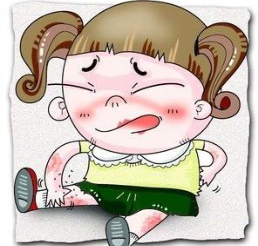 兒童異位性皮炎