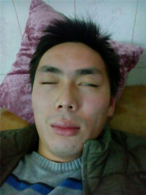 怎麼治療面癱的