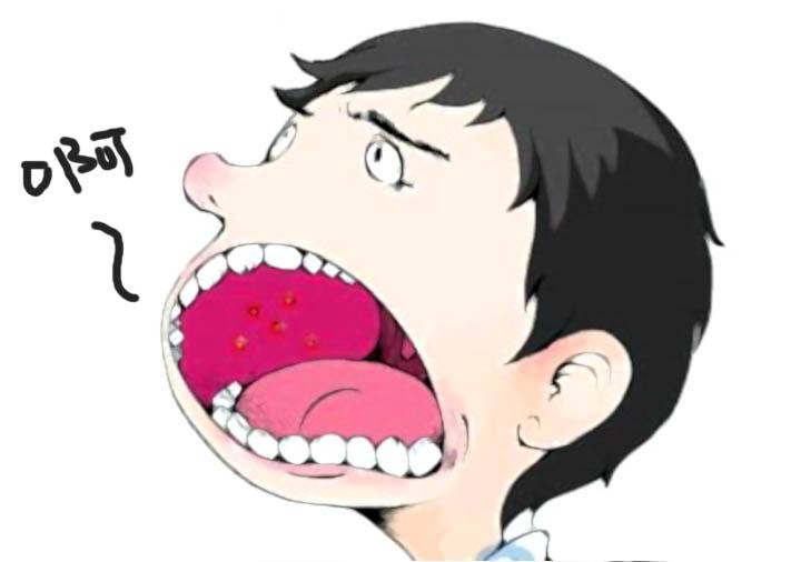 克羅恩病複發性很高 