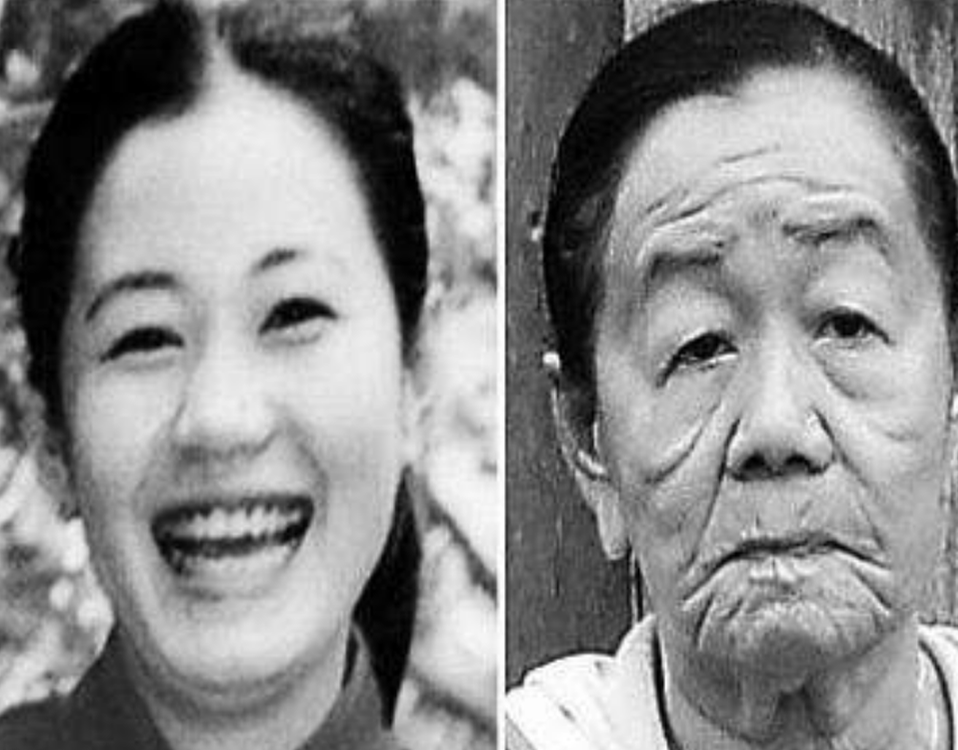 老年人的皮膚老化