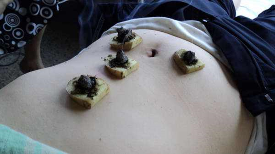 治療慢性結腸炎的土方法的