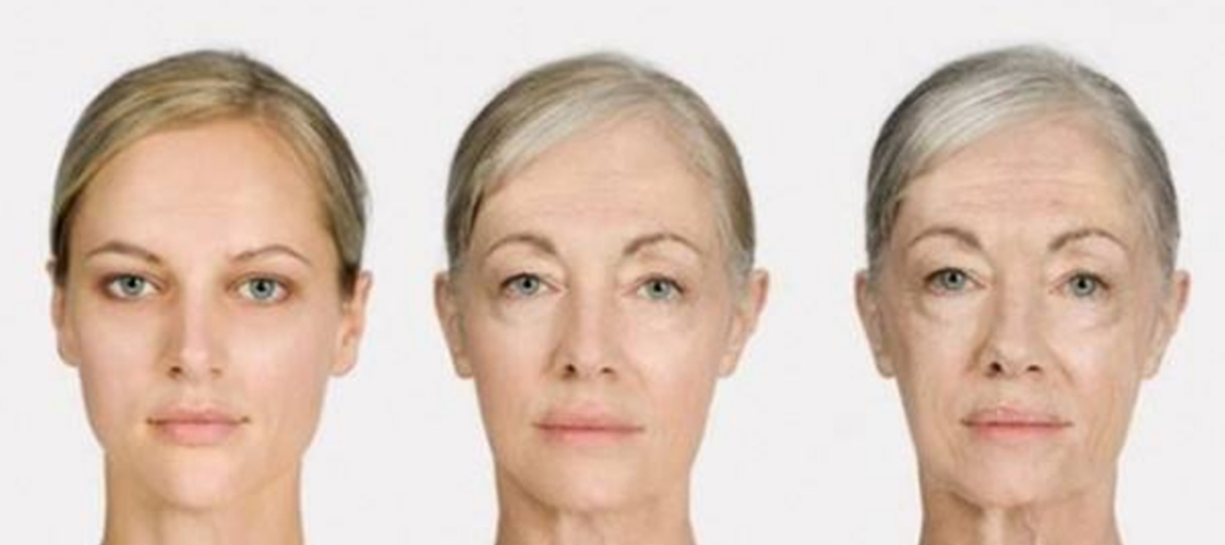 面部皮膚老化