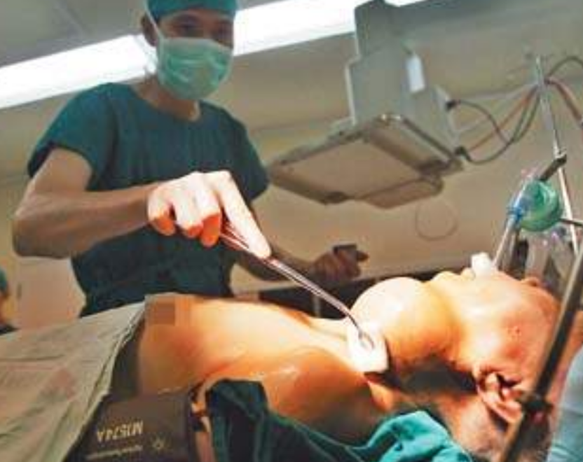 術中淋巴癌早期症狀