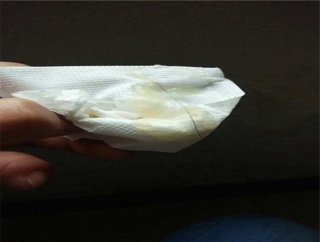 正常精子形態率 