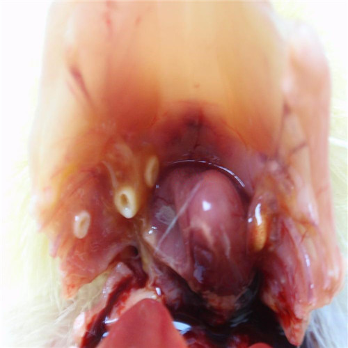 重度呼吸道感染腫大