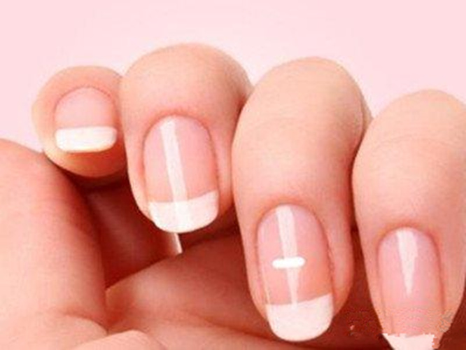 蛔蟲病症狀的表現方式 