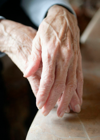 靜止性震顫 (60) 