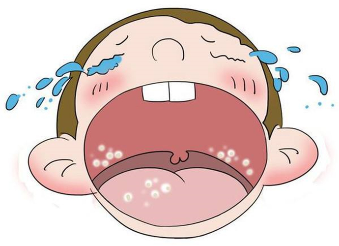 皮膚念珠菌病卡通