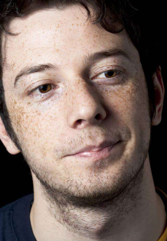 男人臉上長斑的