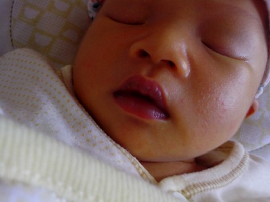 嬰兒嘴唇發紫 (46) 