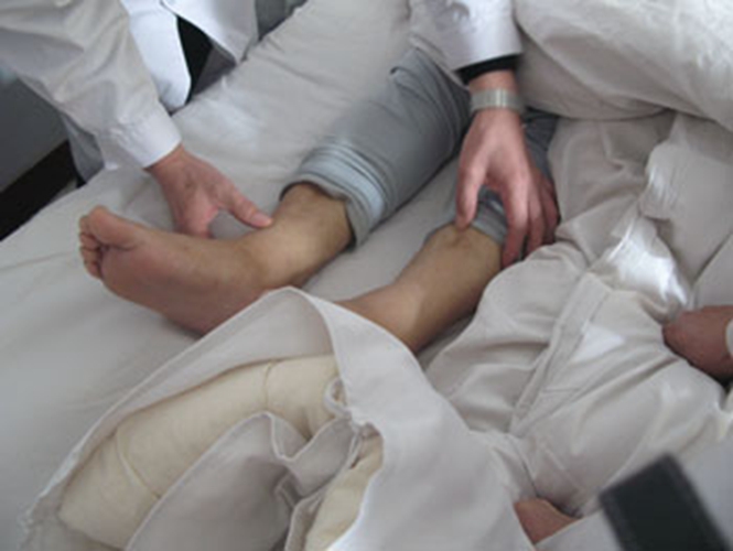 糖尿病腎病治療