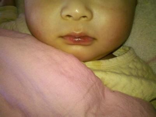 新生兒嘴唇發紫 (4) 