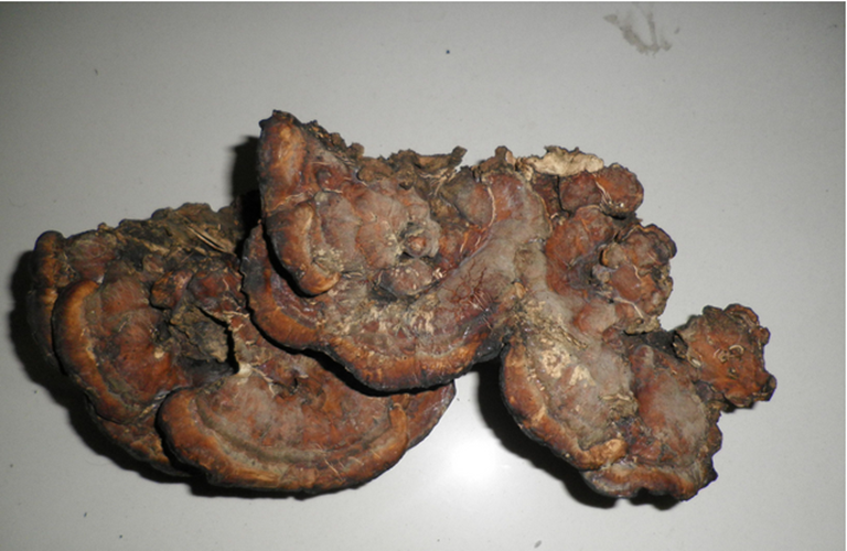 肝門膽管癌晚期死後