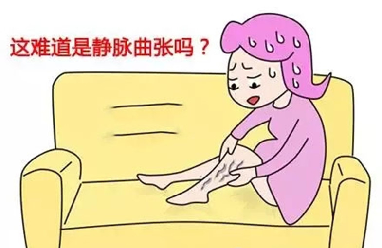 小腿靜脈曲張初期