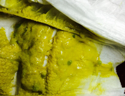 新生兒腹瀉大便