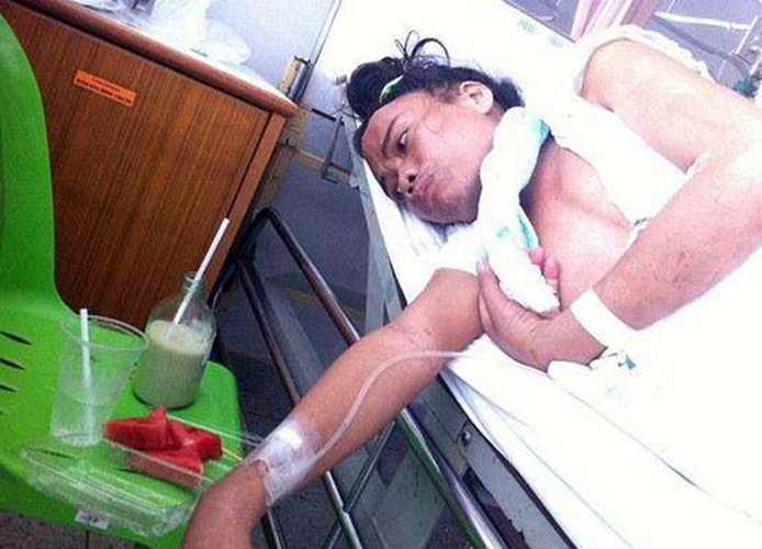 陰莖癌術後護理