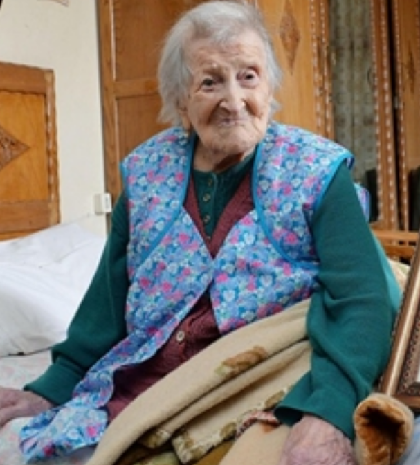 老年女性皮膚老化的