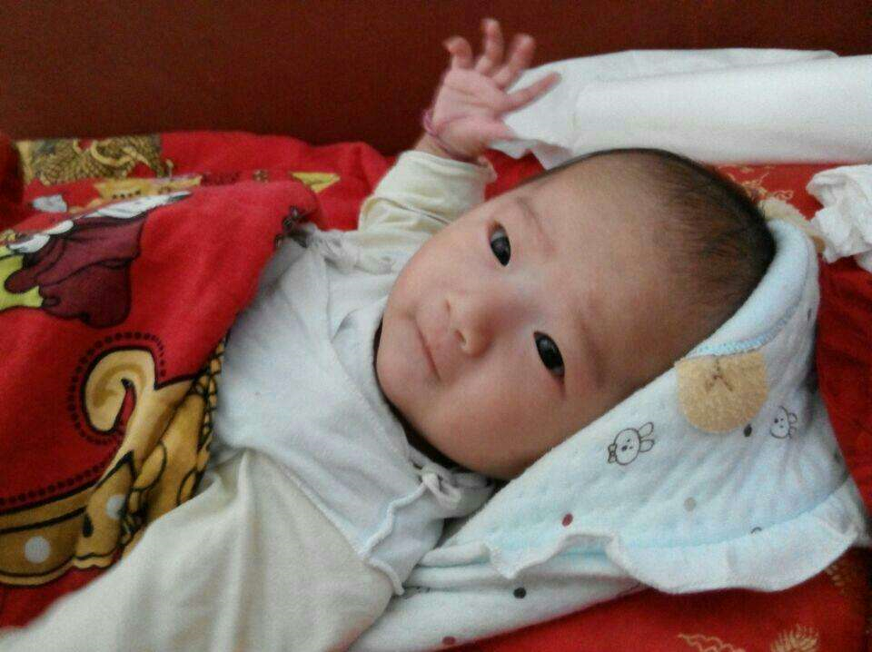 嬰兒先天性喉喘鳴