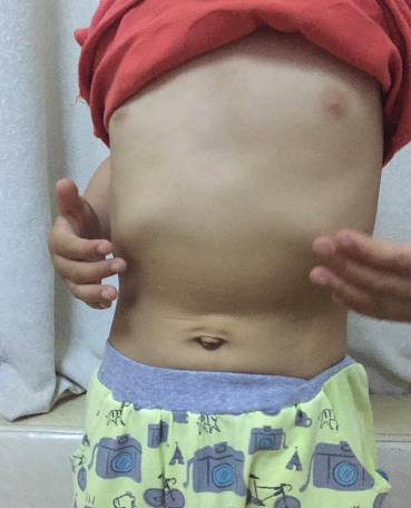 寶寶雞胸圖 (49) 