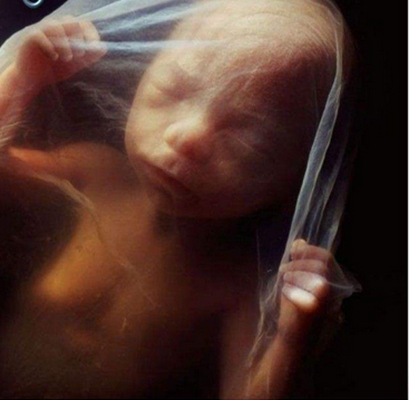 胎兒發育圖 (95) 