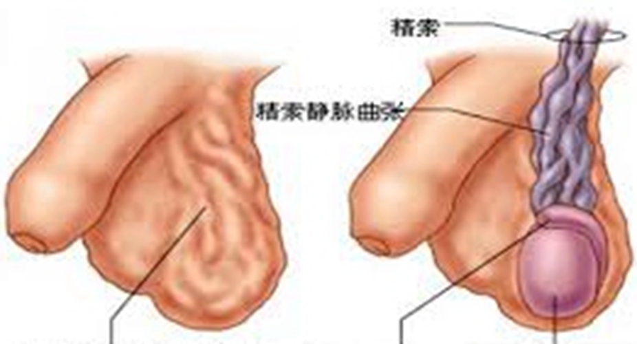 睪丸外形圖解的