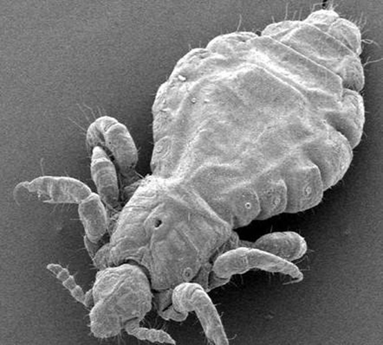 陰蝨要怎麼才能預防