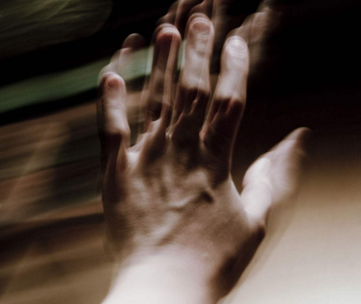 特發性震顫 (51) 