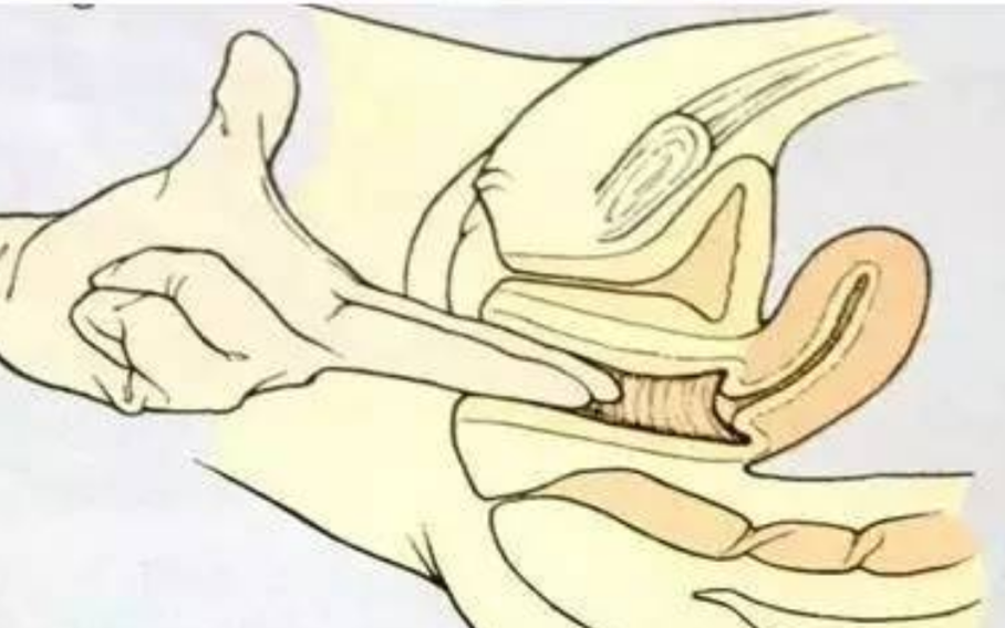 治療中人工陰道漫畫