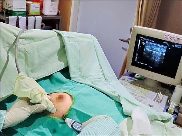 微創治療乳腺纖維瘤